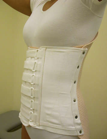 Photo of a spinal brace